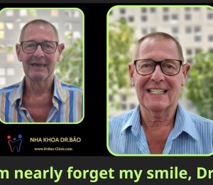 I nearly forget my smile Dr.Bao – A happy smile after dental treatment in Da Nang City