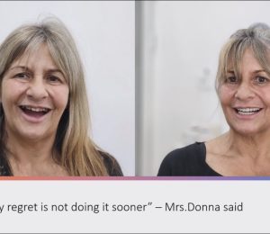 I want to smile again, Doctor