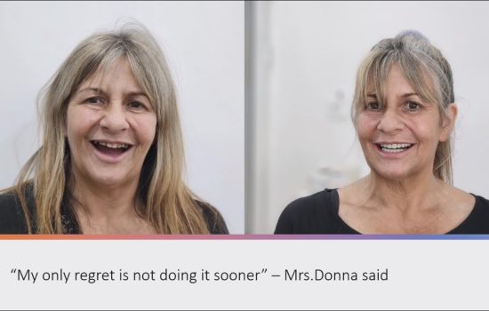 I want to smile again, Doctor