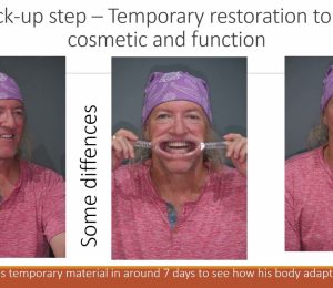 STEP BY STEP – AWAKENING MR.MICHAEL’S SMILE