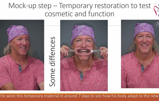 STEP BY STEP – AWAKENING MR.MICHAEL’S SMILE